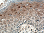 SFRP4 Antibody in Immunohistochemistry (Paraffin) (IHC (P))