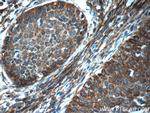 SFRP4 Antibody in Immunohistochemistry (Paraffin) (IHC (P))