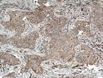 SFRP4 Antibody in Immunohistochemistry (Paraffin) (IHC (P))