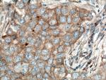 SFRP4 Antibody in Immunohistochemistry (Paraffin) (IHC (P))