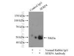 SFRP4 Antibody in Immunoprecipitation (IP)