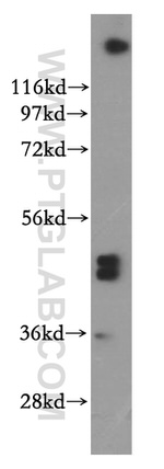 SFRP4 Antibody in Western Blot (WB)