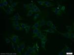 RCL1 Antibody in Immunocytochemistry (ICC/IF)