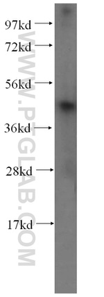 RCL1 Antibody in Western Blot (WB)