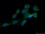 MVD Antibody in Immunocytochemistry (ICC/IF)