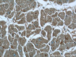 MVD Antibody in Immunohistochemistry (Paraffin) (IHC (P))