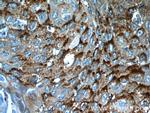 MVD Antibody in Immunohistochemistry (Paraffin) (IHC (P))