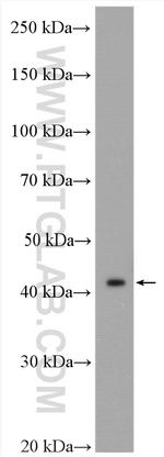 MVD Antibody in Western Blot (WB)