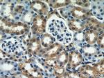 SEPX1 Antibody in Immunohistochemistry (Paraffin) (IHC (P))