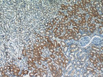 SEPX1 Antibody in Immunohistochemistry (Paraffin) (IHC (P))