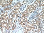 TSTA3 Antibody in Immunohistochemistry (Paraffin) (IHC (P))