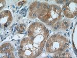 TSTA3 Antibody in Immunohistochemistry (Paraffin) (IHC (P))