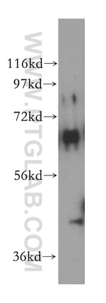 TSTA3 Antibody in Western Blot (WB)