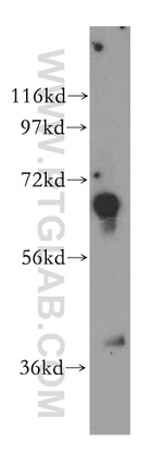 TSTA3 Antibody in Western Blot (WB)