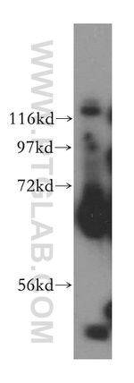 TSTA3 Antibody in Western Blot (WB)