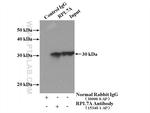 RPL7A Antibody in Immunoprecipitation (IP)