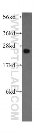 MRPL9 Antibody in Western Blot (WB)