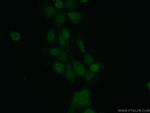 MAD2L1BP Antibody in Immunocytochemistry (ICC/IF)