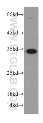 MAD2L1BP Antibody in Western Blot (WB)