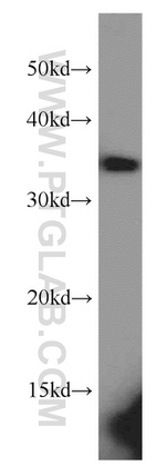 MAD2L1BP Antibody in Western Blot (WB)