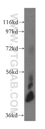 CKMT1A Antibody in Western Blot (WB)