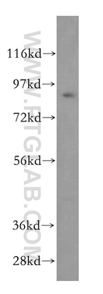 UBA2 Antibody in Western Blot (WB)