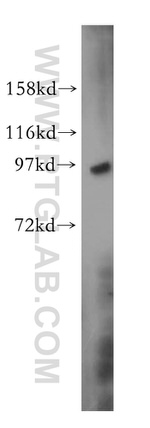 UBA2 Antibody in Western Blot (WB)