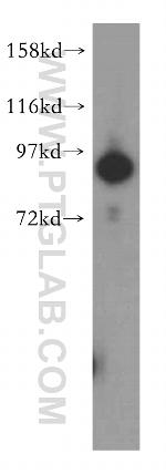 UBA2 Antibody in Western Blot (WB)