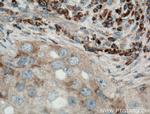 PA2G4 Antibody in Immunohistochemistry (Paraffin) (IHC (P))