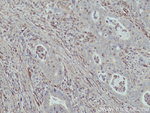 MYL9 Antibody in Immunohistochemistry (Paraffin) (IHC (P))