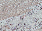 MYL9 Antibody in Immunohistochemistry (Paraffin) (IHC (P))