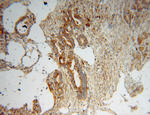 MYL9 Antibody in Immunohistochemistry (Paraffin) (IHC (P))