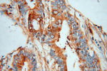 MYL9 Antibody in Immunohistochemistry (Paraffin) (IHC (P))