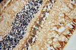 RLBP1 Antibody in Immunohistochemistry (Paraffin) (IHC (P))