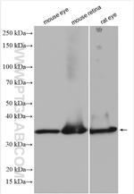 RLBP1 Antibody in Western Blot (WB)