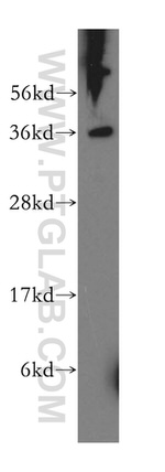 RLBP1 Antibody in Western Blot (WB)