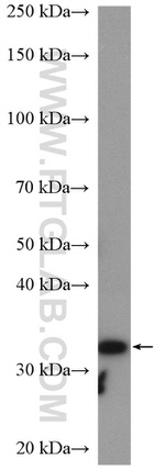 RLBP1 Antibody in Western Blot (WB)