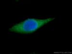 SNUPN Antibody in Immunocytochemistry (ICC/IF)