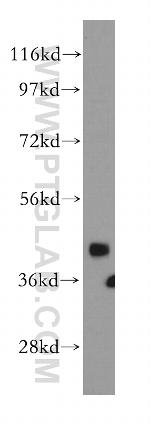 SNUPN Antibody in Western Blot (WB)