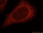 DTYMK Antibody in Immunocytochemistry (ICC/IF)