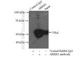 beta Arrestin 1 Antibody in Immunoprecipitation (IP)