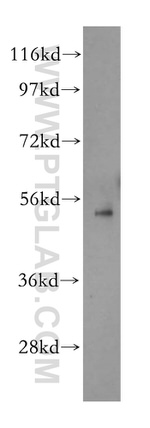 beta Arrestin 1 Antibody in Western Blot (WB)