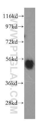 beta Arrestin 1 Antibody in Western Blot (WB)