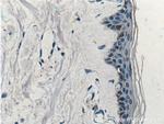 ST6GALNAC1 Antibody in Immunohistochemistry (Paraffin) (IHC (P))