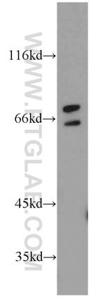 ST6GALNAC1 Antibody in Western Blot (WB)