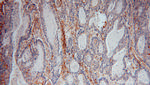 ICAM-1 Antibody in Immunohistochemistry (Paraffin) (IHC (P))