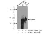 ICAM-1 Antibody in Immunoprecipitation (IP)