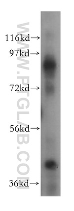 ICAM-1 Antibody in Western Blot (WB)