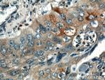 Interferon gamma Antibody in Immunohistochemistry (Paraffin) (IHC (P))