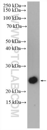 Interferon gamma Antibody in Western Blot (WB)